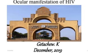 Ocular manifestation of HIV
Getachew. K
December, 201917/12/2019 1
 