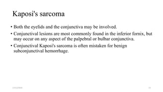 Kaposi's sarcoma
• Both the eyelids and the conjunctiva may be involved.
• Conjunctival lesions are most commonly found in the inferior fornix, but
may occur on any aspect of the palpebral or bulbar conjunctiva.
• Conjunctival Kaposi's sarcoma is often mistaken for benign
subconjunctival hemorrhage.
17/12/2019 13
 