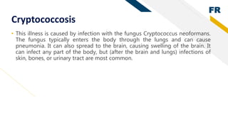 FR
Cryptococcosis
• This illness is caused by infection with the fungus Cryptococcus neoformans.
The fungus typically ente...