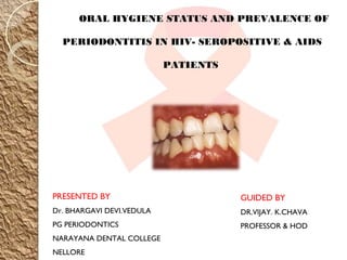 ORAL HYGIENE STATUS AND PREVALENCE OF
PERIODONTITIS IN HIV- SEROPOSITIVE & AIDS
PATIENTS
PRESENTED BY
Dr. BHARGAVI DEVI.VEDULA
PG PERIODONTICS
NARAYANA DENTAL COLLEGE
NELLORE
GUIDED BY
DR.VIJAY. K.CHAVA
PROFESSOR & HOD
 