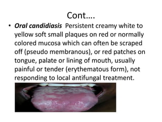 Cont…. 
• Oral candidiasis Persistent creamy white to 
yellow soft small plaques on red or normally 
colored mucosa which can often be scraped 
off (pseudo membranous), or red patches on 
tongue, palate or lining of mouth, usually 
painful or tender (erythematous form), not 
responding to local antifungal treatment. 
 