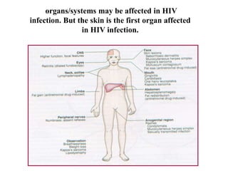 organs/systems may be affected in HIV
infection. But the skin is the first organ affected
in HIV infection.
 