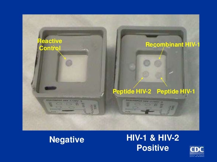 Hiv Testing Procidures By Dr Munawar Khan SACP