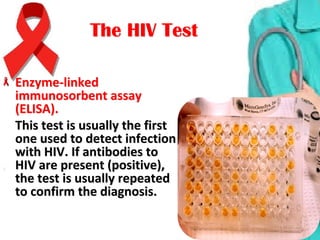 The HIV TestThe HIV Test
Enzyme-linked Enzyme-linked 
immunosorbent assay immunosorbent assay 
(ELISA). (ELISA). 
This test is usually the first This test is usually the first 
one used to detect infection one used to detect infection 
with HIV. If antibodies to with HIV. If antibodies to 
HIV are present (positive), HIV are present (positive), 
the test is usually repeated the test is usually repeated 
to confirm the diagnosis.to confirm the diagnosis.
 