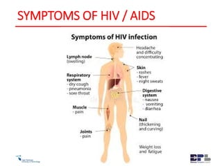 SYMPTOMS OF HIV / AIDS
 
