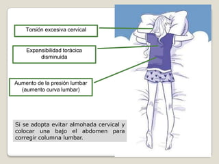 Torsión excesiva cervical
Expansibilidad torácica
disminuida
Aumento de la presión lumbar
(aumento curva lumbar)
Si se adopta evitar almohada cervical y
colocar una bajo el abdomen para
corregir columna lumbar.
 