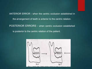 ANTERIOR ERROR - when the centric occlusion established in
the arrangement of teeth is anterior to the centric relation.
POSTERIOR ERRORS - when centric occlusion established
is posterior to the centric relation of the patient.
 