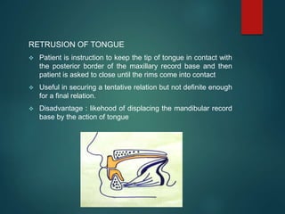 RETRUSION OF TONGUE
 Patient is instruction to keep the tip of tongue in contact with
the posterior border of the maxillary record base and then
patient is asked to close until the rims come into contact
 Useful in securing a tentative relation but not definite enough
for a final relation.
 Disadvantage : likehood of displacing the mandibular record
base by the action of tongue
 