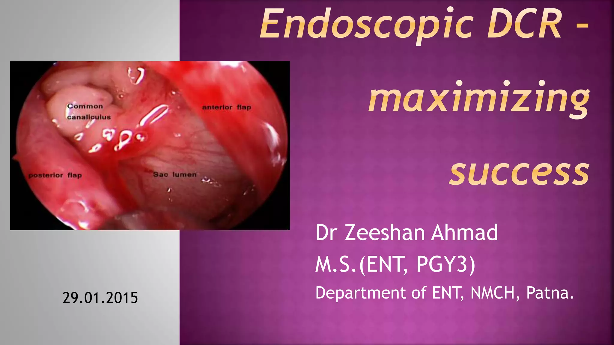 Dr Zeeshan Ahmad
M.S.(ENT, PGY3)
Department of ENT, NMCH, Patna.29.01.2015