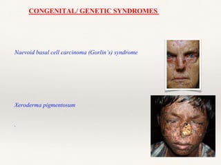 CONGENITAL/ GENETIC SYNDROMES
Naevoid basal cell carcinoma (Gorlin’s) syndrome
Xeroderma pigmentosum
.
 