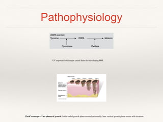 Pathophysiology
Clark’s concept—Two phases of growth: Initial radial growth phase occurs horizontally, later vertical growth phase occurs with invasion.
UV exposure is the major causal factor for developing MM.
 