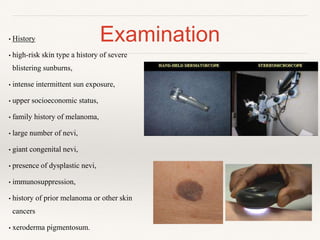 Examination• History
• high-risk skin type a history of severe
blistering sunburns,
• intense intermittent sun exposure,
• upper socioeconomic status,
• family history of melanoma,
• large number of nevi,
• giant congenital nevi,
• presence of dysplastic nevi,
• immunosuppression,
• history of prior melanoma or other skin
cancers
• xeroderma pigmentosum.
 