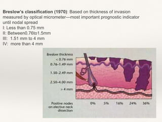 Breslow’s classification (1970): Based on thickness of invasion
measured by optical micrometer—most important prognostic indicator
until nodal spread
I: Less than 0.75 mm
II: Between0.76to1.5mm
III: 1.51 mm to 4 mm
IV: more than 4 mm
 