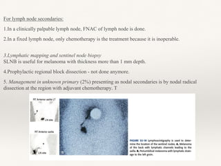 For lymph node secondaries:
1.In a clinically palpable lymph node, FNAC of lymph node is done.
2.In a fixed lymph node, only chemotherapy is the treatment because it is inoperable.
3.Lymphatic mapping and sentinel node biopsy
SLNB is useful for melanoma with thickness more than 1 mm depth.
4.Prophylactic regional block dissection - not done anymore.
5. Management in unknown primary (2%) presenting as nodal secondaries is by nodal radical
dissection at the region with adjuvant chemotherapy. T
 