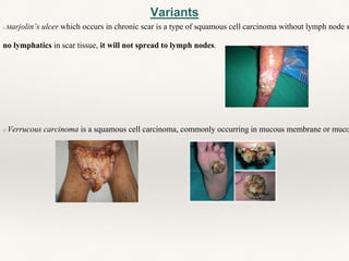 Variants
o Marjolin’s ulcer which occurs in chronic scar is a type of squamous cell carcinoma without lymph node s
no lymphatics in scar tissue, it will not spread to lymph nodes.
o Verrucous carcinoma is a squamous cell carcinoma, commonly occurring in mucous membrane or muco
 