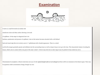 Examination
It starts as a small brownish-red nodule with
translucent colour and shiny surface showing a net work
of capillaries. At this stage it is diagnosed due to its
hardness, painlessness and presence of capillaries. Later on the tumour becomes ulcerated with a well defined
hard and raised edge (but not everted as seen in ^ epithelioma) with a beaded appearance. There is a central
scab but the margin gradually spreads and infiltrates into the surrounding tissues as well as deeper tissues even up to the bone. This characteristic feature of eroding the
tissues, which come in contact with it, has given it the name ‘rodent’. At first it may itch, but at a later stage it may be painful if it has eroded any nerve.
Dissemination by lymphatic or blood vessels does not occur. So the regional lymph nodes are not enlarged and there will be no metastasis to the distant organs. There may
be squamous celled carcinomatous change, though very rare.
 