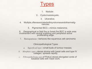 1. Nodular.
2. Cystic/nodulocystic.
3. Ulcerative.
4. Multiple,oftenassociatedwithsyndromesandothermalig-
nancies.
5. Pigmented BCC—mimics melanoma.
6. Geographical or field fire or forest fire BCC is wide area
involvement with central scabbing and peripheral active
proliferating edge.
7. Basisquamous—behaves like squamous cell carcinoma
Clinicopathological Types
a. Superficial type—small buds of tumour masses.
b. Morpheic type—dense stroma with basal cells and type IV
collagen; spreads rapidly.
c. Fibroepithelioma type of Pinkus shows elongated cords of
basaloid cells with mesh work.
Types
 