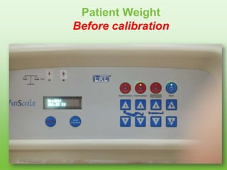 Patient Weight
Before calibration
 