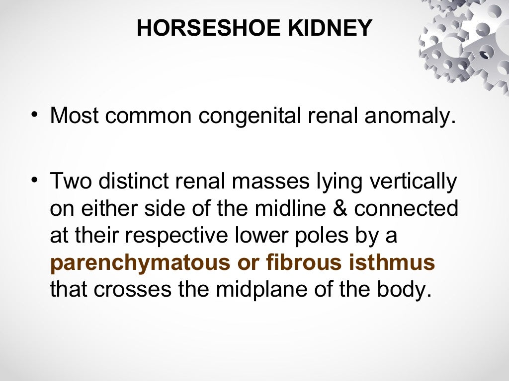 Horseshoe kidney & PCNL
