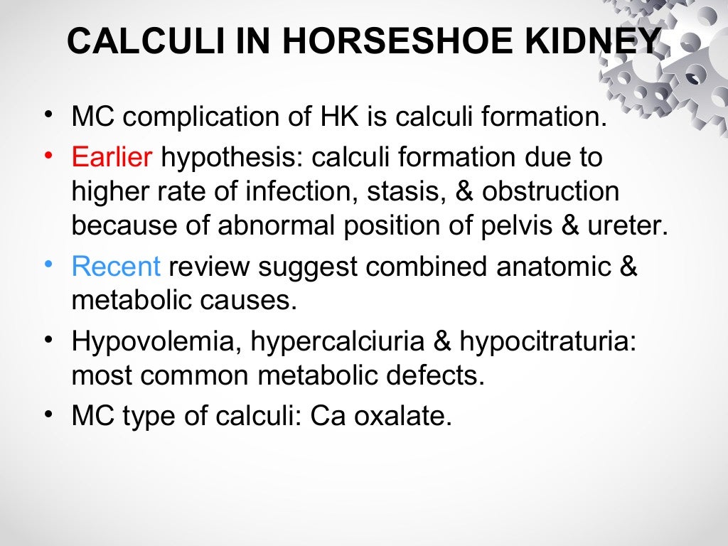 Horseshoe kidney & PCNL