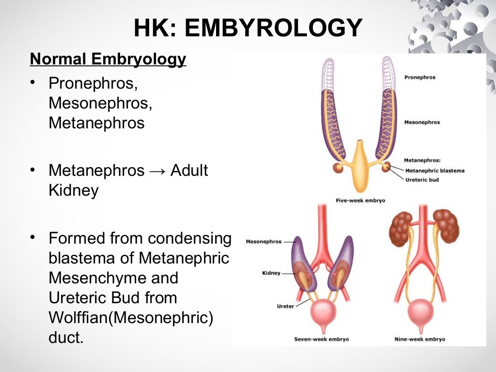 Horseshoe kidney & PCNL
