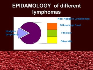 EPIDAMOLOGY of different
lymphomas
Hodgkin
lymphoma
NHL
Diffuse large B-cell
Follicular
Other NHL
Non-Hodgkin Lymphomas
 