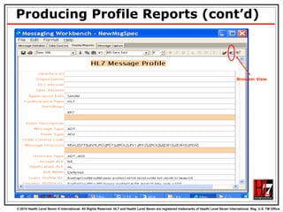 Producing Profile Reports (cont’d) Browser View 