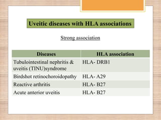 Hla associated uveitis | PPTX