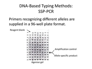 DNA-Based Typing Methods:
SSP-PCR
Primers recognizing different alleles are
supplied in a 96-well plate format.
Amplification control
Allele-specific product
Reagent blank
Agarose gel
 