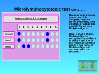 Microlymphocytotoxic test  Contd …. Because cells express numerous HLA  antigens, they are tested separately with a battery of antibodies specific for various HLA-A antigens.  Here, donor 1 shares HLA-A antigens recognized by antisera in wells 1 and 7 with the recipient, whereas donor 2 has none of HLA-A antigens in common with the recipient. 