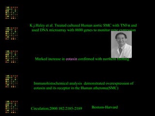 K.j.Haley et al. Treated cultured Human aortic SMC with TNFα and
used DNA microarray with 8600 genes to monitor gene expression
Marked increase in eotaxin confirmed with northern blotting
Immunohistochemical analysis demonstrated overexpression of
eotaxin and its receptor in the Human atheroma(SMC)
Circulation;2000:102:2185-2189 Bostom-Harvard
 