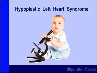 Hypoplastic Left Heart Syndrome
 