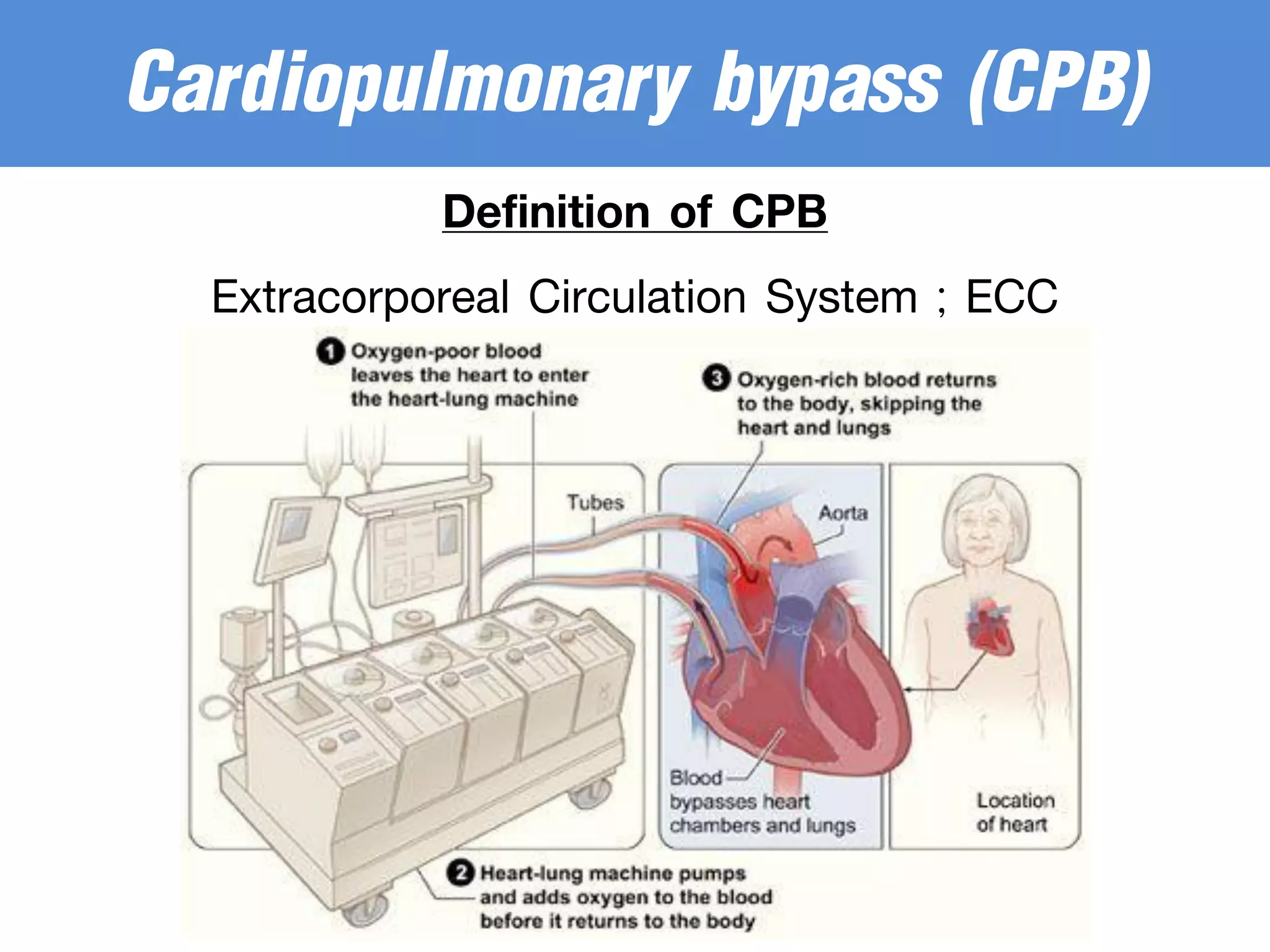 Definition of CPB
Extracorporeal Circulation System ; ECC
Cardiopulmonary bypass (CPB)
 
