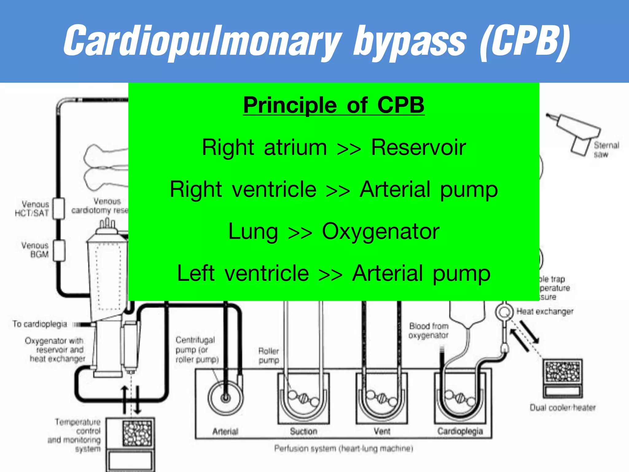 Principle of CPB
Right atrium >> Reservoir
Right ventricle >> Arterial pump
Lung >> Oxygenator
Left ventricle >> Arterial pump
Cardiopulmonary bypass (CPB)
 