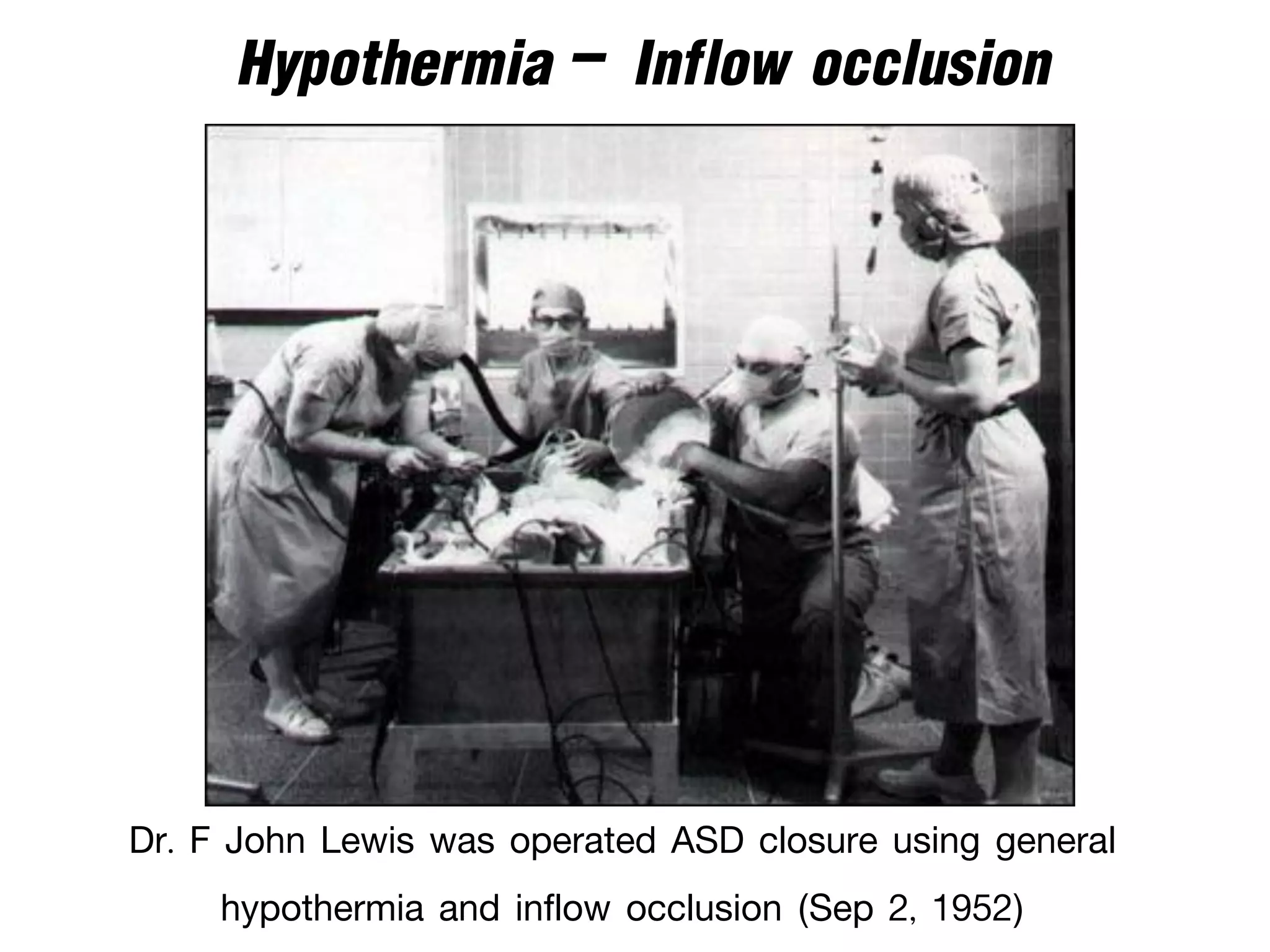 Hypothermia - Inflow occlusion
Dr. F John Lewis was operated ASD closure using general
hypothermia and inflow occlusion (Sep 2, 1952)
 