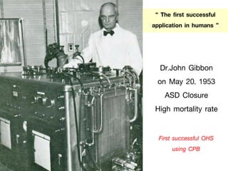 Dr.John Gibbon
on May 20, 1953
ASD Closure
High mortality rate
“ The first successful
application in humans ”
First successful OHS
using CPB
 