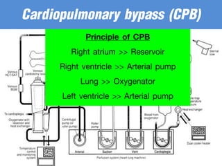 Principle of CPB
Right atrium >> Reservoir
Right ventricle >> Arterial pump
Lung >> Oxygenator
Left ventricle >> Arterial pump
Cardiopulmonary bypass (CPB)
 