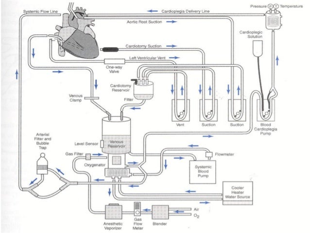 Heart Lung Machine Diagram