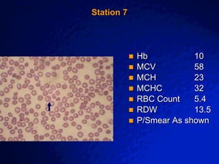 © 2003 By Default!
A Free sample background from www.awesomebackgrounds.com
Slide 14
Station 7
 Hb 10
 MCV 58
 MCH 23
 MCHC 32
 RBC Count 5.4
 RDW 13.5
 P/Smear As shown
 