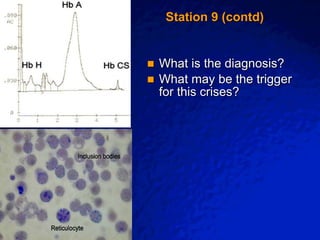 © 2003 By Default!
A Free sample background from www.awesomebackgrounds.com
Slide 19
Station 9 (contd)
 What is the diagnosis?
 What may be the trigger
for this crises?
 