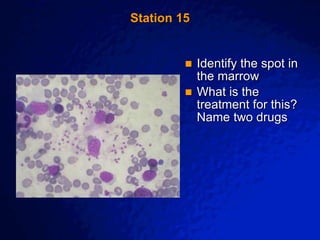 © 2003 By Default!
A Free sample background from www.awesomebackgrounds.com
Slide 32
Station 15
 Identify the spot in
the marrow
 What is the
treatment for this?
Name two drugs
 
