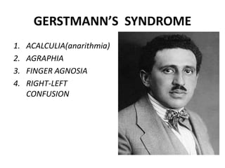 GERSTMANN’S SYNDROME
1. ACALCULIA(anarithmia)
2. AGRAPHIA
3. FINGER AGNOSIA
4. RIGHT-LEFT
CONFUSION
 