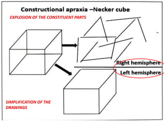 EXPLOSION OF THE CONSTITUENT PARTS
SIMPLIFICATION OF THE
DRAWINGS
 