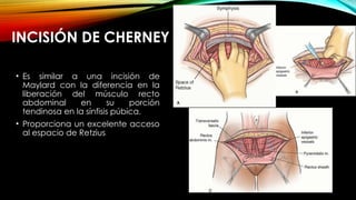 cesarea y tecnicas nuevas en obstetricia | PPTX