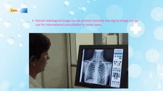 Cont…
 Stored radiological image can be printed normally and digital image can be
use for international consultation in some cases.
 
