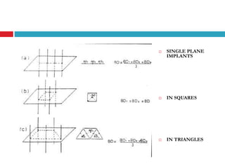  SINGLE PLANE
IMPLANTS
 IN SQUARES
 IN TRIANGLES
 