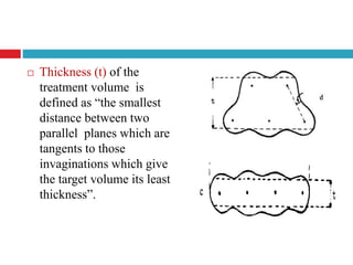  Thickness (t) of the
treatment volume is
defined as “the smallest
distance between two
parallel planes which are
tangents to those
invaginations which give
the target volume its least
thickness”.
 