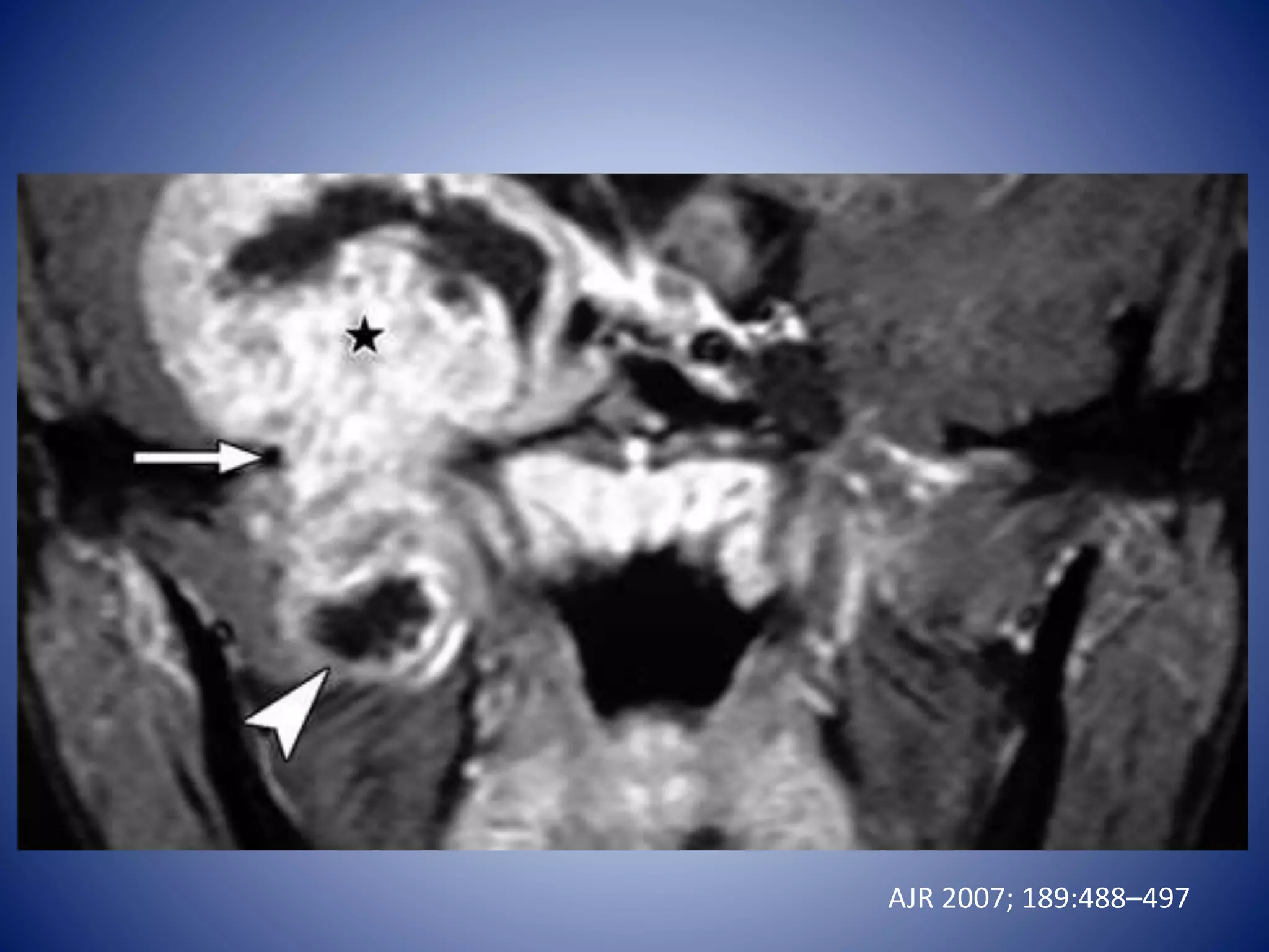 HEAD AND NECK cross sectional pet ct anatomy | PPTX