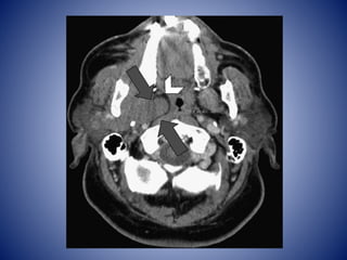 HEAD AND NECK cross sectional pet ct anatomy | PPTX