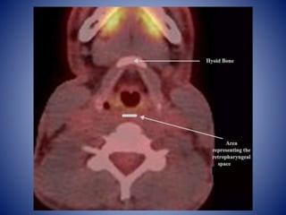 HEAD AND NECK cross sectional pet ct anatomy | PPTX